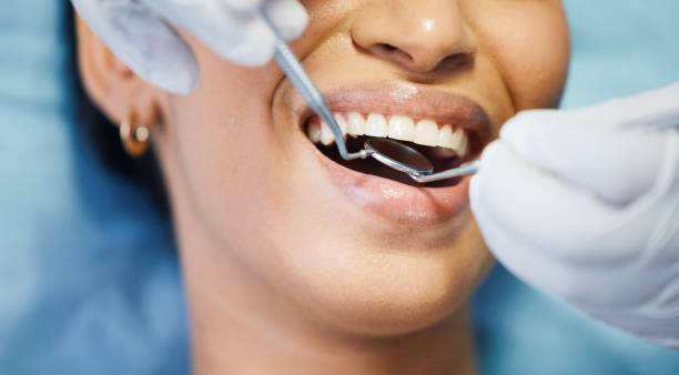 Best After-Hours Dental Trauma Care in Keokuk, IA