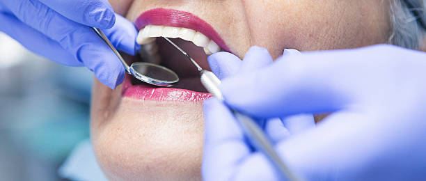 Best Cosmetic Emergency Dentistry in Keokuk, IA